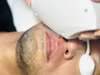 ソルテシュガーリング(SORTE sugaring)の写真/【髭,全身脱毛が人気】シュガーリング×美容脱毛!白髪もシュガーリングでその場できれいに！ツルスベ肌へ♪