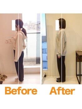 整体院ひなた 宮崎院/側湾が改善し肩こり腰痛改善!!