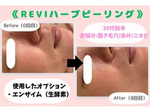 ウル 下北沢(Ulu)/REVIハーブピーリング