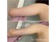 エステティックサロン フェアリー(ESTHETIC SALON FAIRLY)の写真
