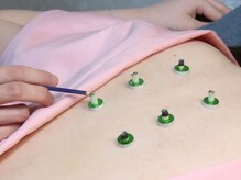 鍼灸院アム(Amu)/