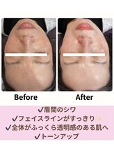 ミミ(mimi)/初回のお客様の変化！