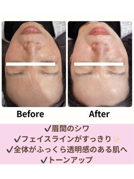 ミミ(mimi)/初回のお客様の変化!