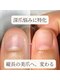 ロゼッティ(ROSETTY)の写真/生まれつきと諦めていた深爪・爪噛みのお悩みに◎育成のプロの丁寧なケアで自分史上最高の美しい縦長美爪へ