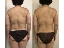 ジュメル 恵比寿店(Jumelles)/キレイなくびれ♪