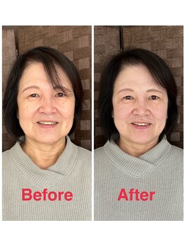 サントーシャ(Santosha)/お顔全体の引き上がり♪