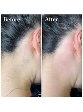 ホワイトワックス 京都四条烏丸(WHITE WAX)/シェービングやめて！wax脱毛！