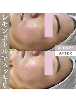 ルームエイトエイティスリー 新宿(R883)/レモンボトルでスッキリ！