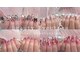 ビューティー スイートピー(beauty Sweetpea)の写真