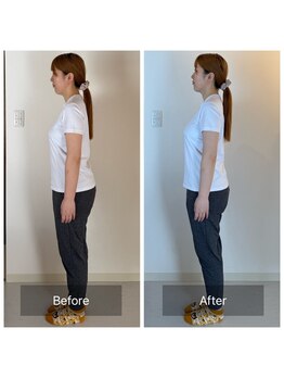 アリス(Alice)/骨格矯正・骨盤矯正