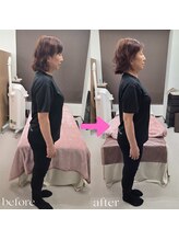 あした葉 カイロプラクティック/☆骨盤小顔調整☆