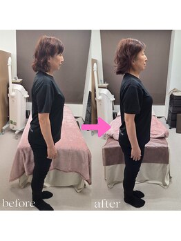 あした葉 カイロプラクティック/☆骨盤小顔調整☆