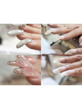 爪の悩みを解消できる（ケア含む）