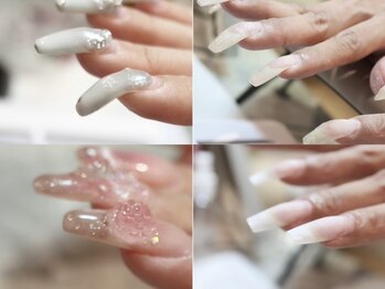 ネイルルーム アイボリー(nail room ivory)の写真/【下がり爪を独自の技法で真っ直ぐに!】美しいフォルムに拘るネイル上級者のお客さまも多数ご来店◎