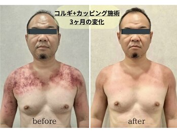 アグレーブル(Agreable)/頭痛や眼精疲労、慢性こり解消