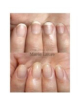 マリーロール 淀屋橋本店(Marie Laure)/深爪矯正/自爪育成/ネイルケア
