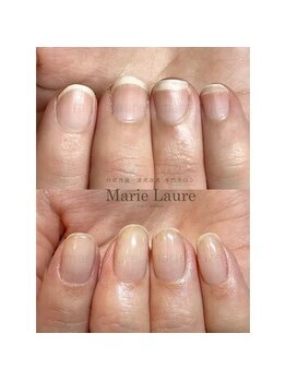 マリーロール 淀屋橋本店(Marie Laure)/深爪矯正/自爪育成/ネイルケア