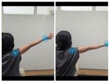 中総持寺鍼灸院【肩こり/肩甲骨/腰痛/姿勢矯正/美容鍼】/