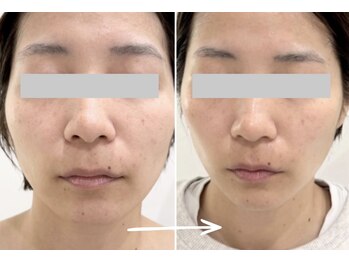 ココビ 多治米店(COCOVI)/ノーファンデでも自信が持てる肌