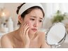 アクネ菌ケアコース[80分]6,050円→5,050円（初来店の方のみ1,000円オフ！）