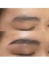 シャンドラ(Shandora)/メンズブロウリフト