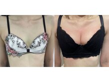 エスグレース 梅田店(S.grace)/ヘッドスパ痩身バストケアリンパ