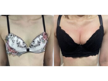 エスグレース 梅田店(S.grace)/ヘッドスパ痩身バストケアリンパ