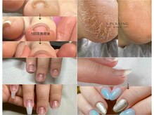 ルクール(Le Coeur)の雰囲気（巻爪、深爪、反り爪、今まで不可能だったかかとケアのお悩みも◎）