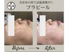 韓国最新美容！水光肌【プラピール】プラズマシャワー無料パック付き¥13000