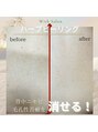 ウィズサロン(withサロン) 背中のハーブピーリング【8g】