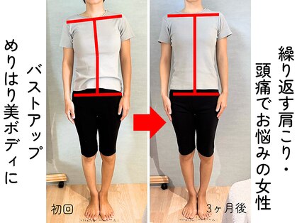 リノ(Lino)の写真
