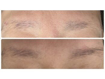 アリガトウ サロン シンパシー(A.Salon Sympathy)/眉毛も伸びます。眉毛美容液導入