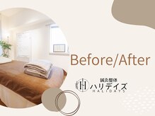 ハリデイズ/施術前後の変化です！