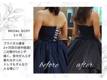 アモリール(Amolir)/ブライダル痩身M様