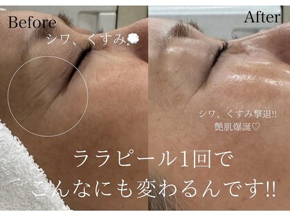 コンフィデンス(Confidence)の写真