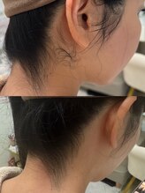 さとう美容整体 川崎本店/うなじブライダル