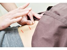 リケア鍼灸整骨院/【和光市/朝霞//志木/新座】