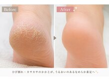 ロッティ(Lottie)