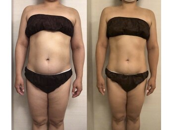 ジュメル 恵比寿店(Jumelles)/お腹のお肉とさよなら(^^)/～