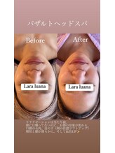 ララルアナ(Lara luana)/極上ヘッドスパ体験
