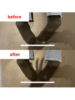 ナオル整体 福岡香椎院(NAORU整体)/40代女性施術事例【骨盤矯正】