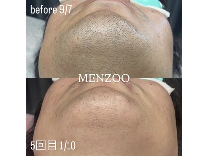 メンズー(MENZOO)の写真