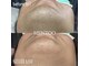 メンズー(MENZOO)の写真