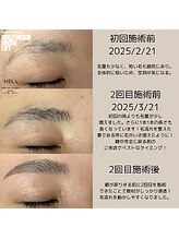 ミスズ(MISUZU)/比較画像～HBL～