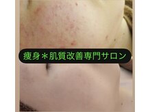 スズ(SUZU)の雰囲気（敏感肌の方も◎お悩み別肌質改善＊最新のお肌管理）