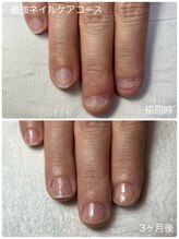 ネイルブルームーン(Nail Blue Moon)/最強ネイルケアコース