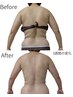 【本気で痩せたい方限定】6種の痩身技術でセル脂肪徹底撃退！￥19800→￥4980