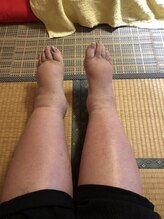 リデザイン 京都(REDESIGN)/REDESIGN京都中医施術法