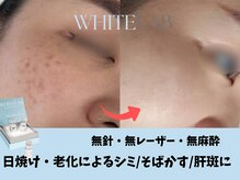 エングラッシー(en glassy)の雰囲気（塗るだけシミケア！ホワイトラボ◎一度でシミがペロン！）