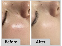 エマクラン(emmaclan)/